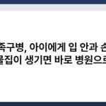 수족구병, 아이에게 입 안과 손발 물집이 생기면 바로 병원으로 2