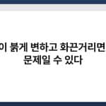 손발이 붉게 변하고 화끈거리면 혈관 문제일 수 있다 5